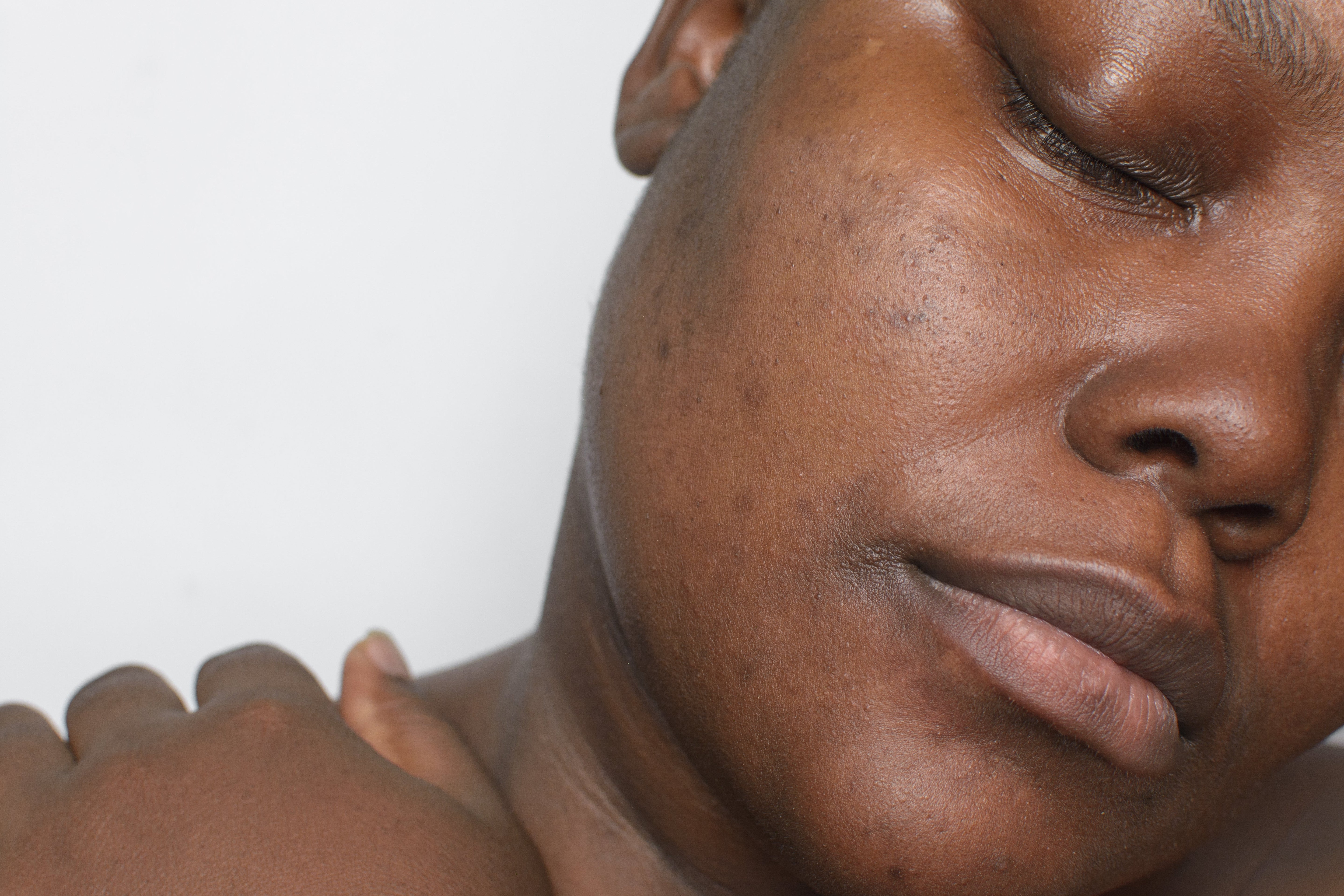 Products I Recommend For Hyperpigmentation as a Dermatologist